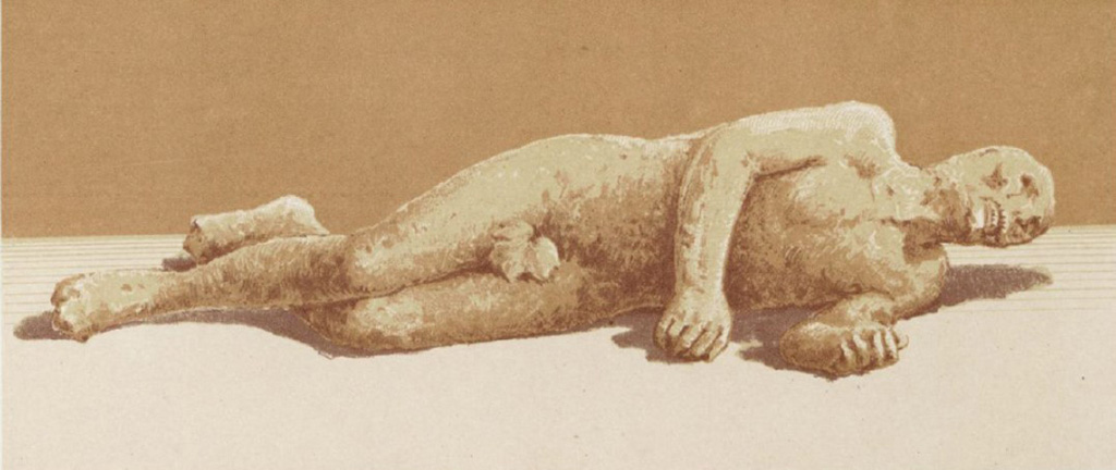 Calco B. Man resting on his left side, found 12th August 1889, outside the Porta Stabia.
According to Niccolini,
A male completely nude, leaning on his left side, with the hands clenched: while the head has nothing but a horrible skull, all the body and especially the back was perfectly successful.
See Niccolini F, 1890. Le case ed i monumenti di Pompei: Volume Terzo. Napoli. Tav. III, fig. 2.
A plaster cast of a fig leaf was added over the phallus when the cast of the victim was displayed in the Pompeii Antiquarium.
See Osanna, N., Capurso, A., e Masseroli, S. M., 2021. I Calchi di Pompei da Giuseppe Fiorelli ad oggi: Studi e Ricerche del PAP 46, p. 545, Calco B.