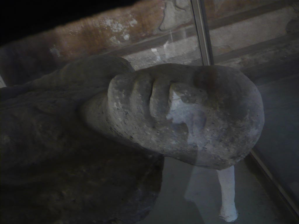 VII.1.8 Pompeii. May 2012. Victim 15. Detail of head of plaster cast of body, in men’s changing room 2.
Photo courtesy of Buzz Ferebee.