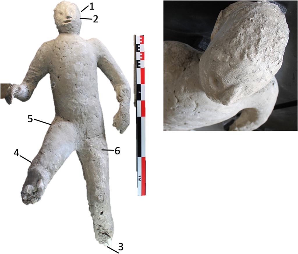 Victim 59. Cast, numbered as #64 in the casts of Pompeii Project, and pXRF measuring points (1–6).
The cast #64 is a male adult individual between 45 and 50 years old, very altered and remodelled in an old restoration, especially in the zygomatic-facial area. This individual was originally found supine, with the upper extremities separated from the body.
Cast #64 presents osteoarthritis in the right knee and in the medial condyle of left femur.
Photo courtesy of The Casts of Pompeii Project. Use subject to CC BY 4.0 Deed
See Alapont L, Gallello G, Martinón-Torres M, Osanna M, Amoretti V, Chenery S, et al. (2023) The casts of Pompeii: Post-depositional methodological insights. PLoS ONE 18(8): e0289378, fig. 5. https://doi.org/10.1371/journal.pone.0289378
This photo seems to correspond with those in the catalogue for victim 59.
See Osanna, N., Capurso, A., e Masseroli, S. M., 2021. I Calchi di Pompei da Giuseppe Fiorelli ad oggi: Studi e Ricerche del PAP 46, p. 459-460, Calco n. 59.