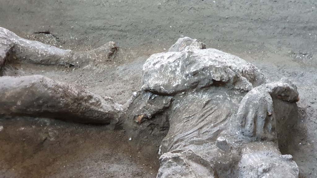 November 2020. Victim 92, upper torso.
The presence of a series of vertebral compressions, unusual in a young man of his age, would suggest that he had carried out hard manual work. He could therefore have been a slave.
Novembre 2020. Vittima 92, torso superiore.
La presenza di una serie di schiacciamenti vertebrali, inusuali per la giovane età dell’individuo, fa ipotizzare anche lo svolgimento di lavori pesanti. Poteva dunque trattarsi di uno schiavo.
Photograph © Parco Archeologico di Pompei.