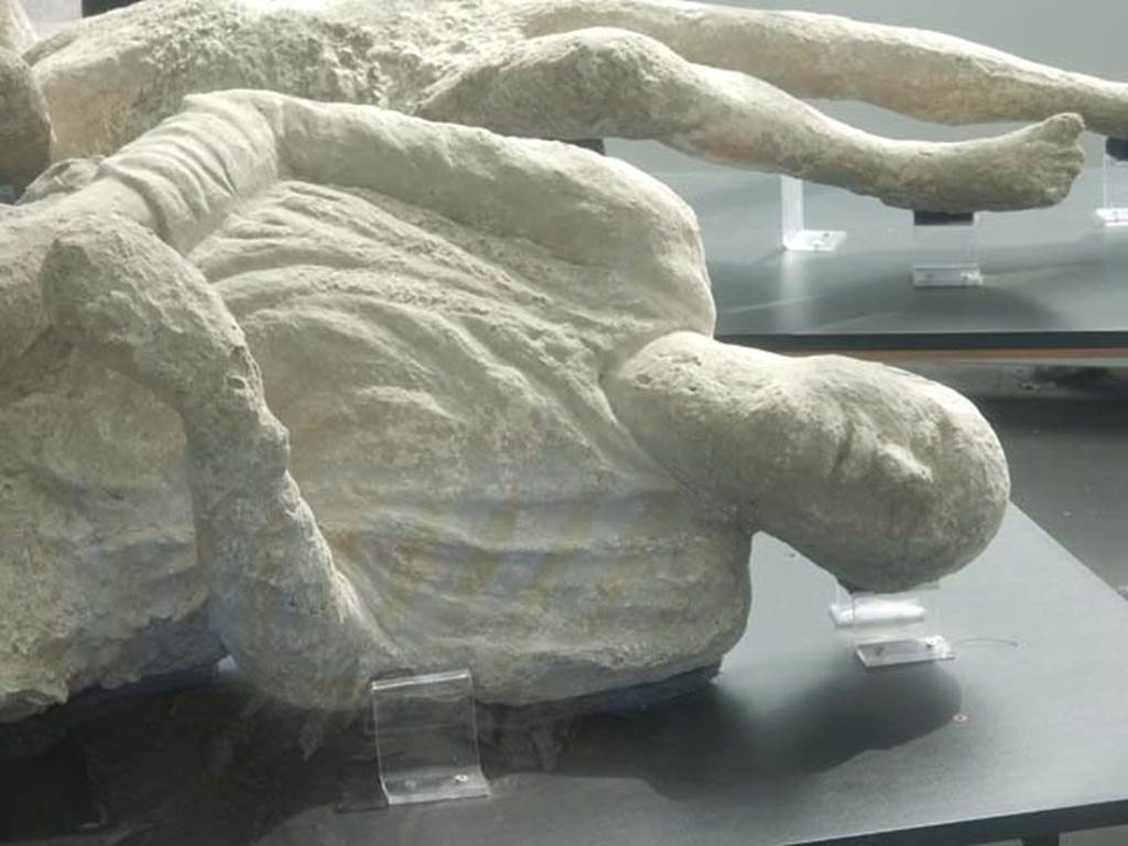 Pompeii. May 2018. Detail of Victim known as number 16, found outside the Stabian Gate.
Photo courtesy of Buzz Ferebee.